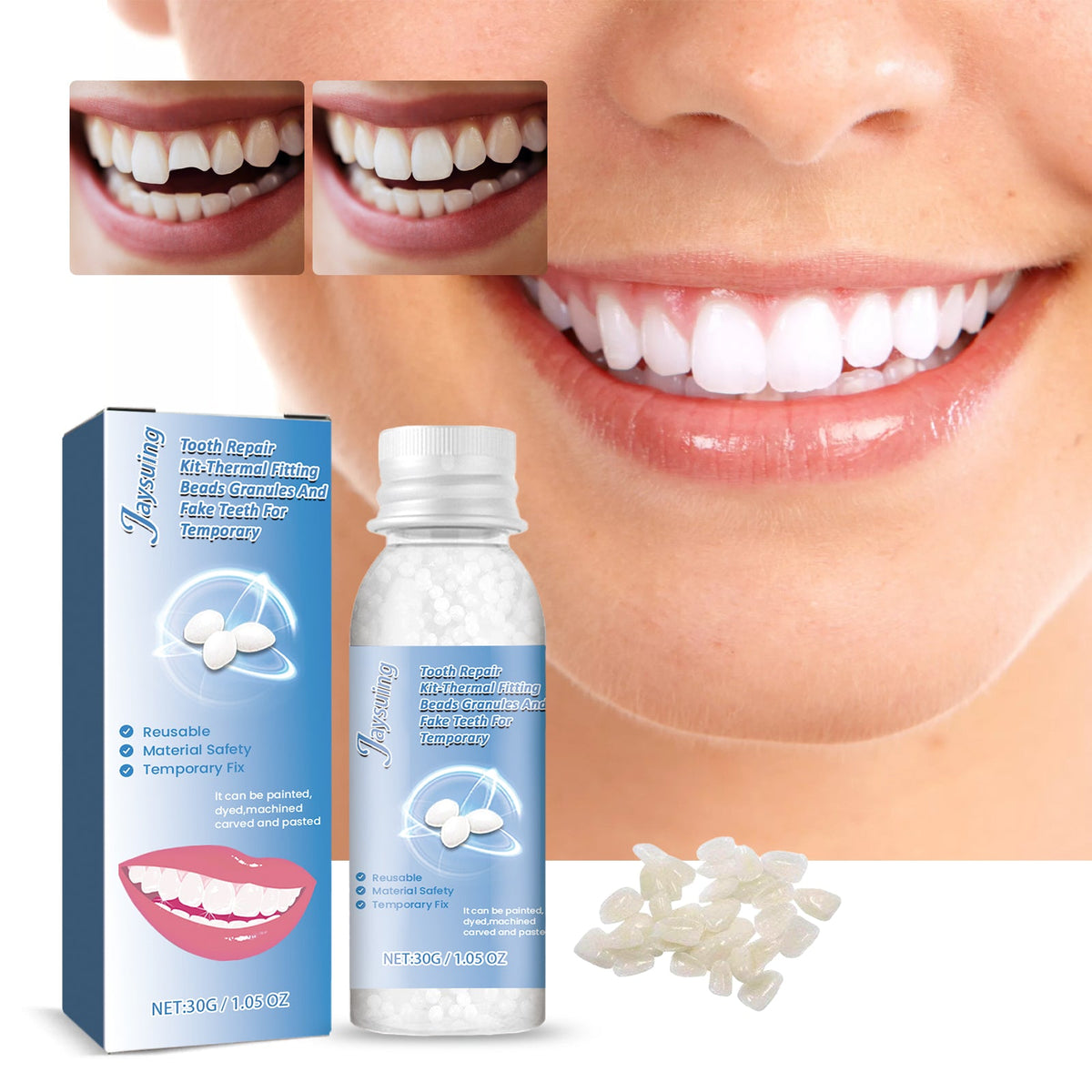 Dental repair kit with bottle, box, and white beads beside smiling teeth