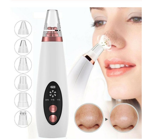 White handheld microcrystalline blackhead remover device with clear suction tip
