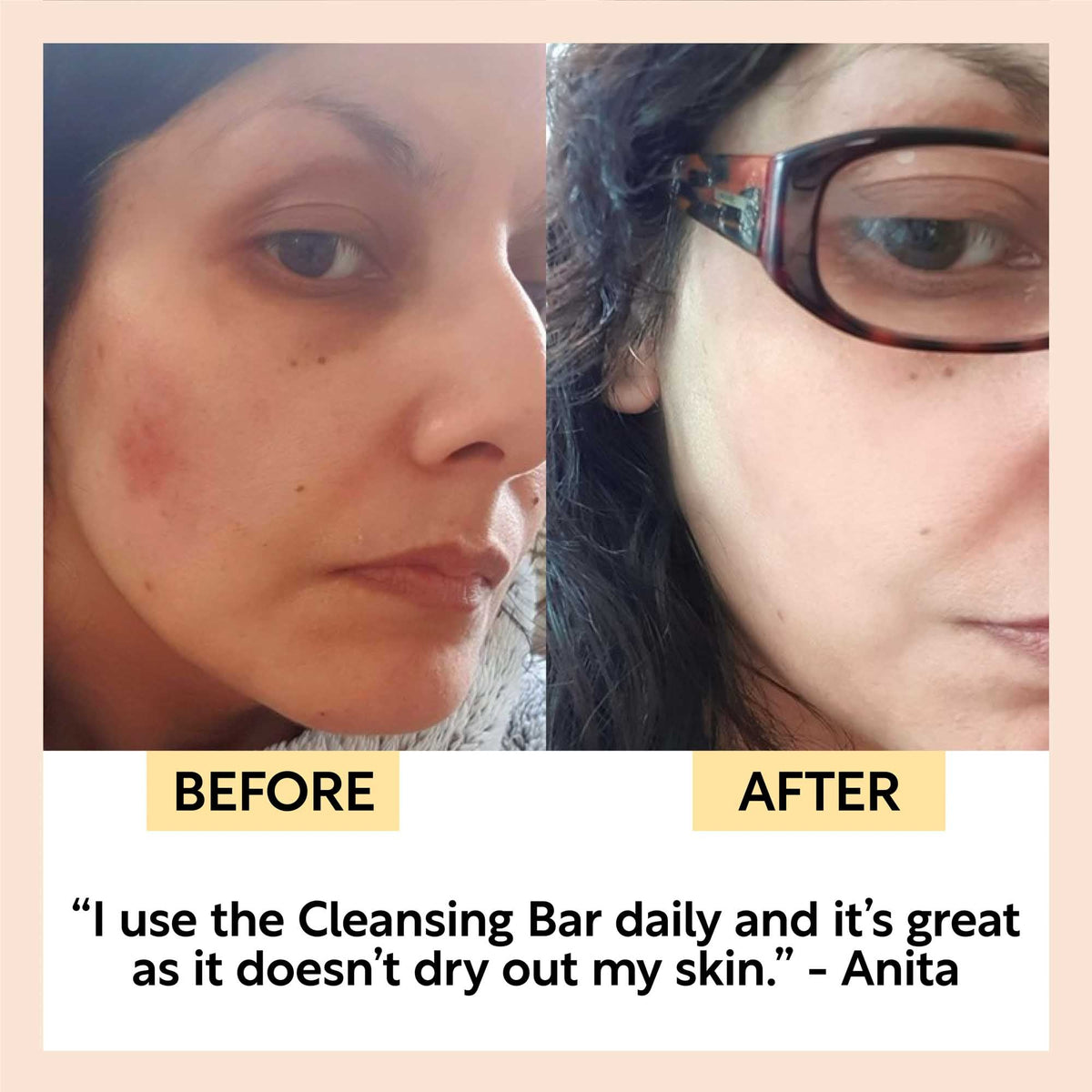 Split before-and-after face photos showing skin results after using a cleansing bar
