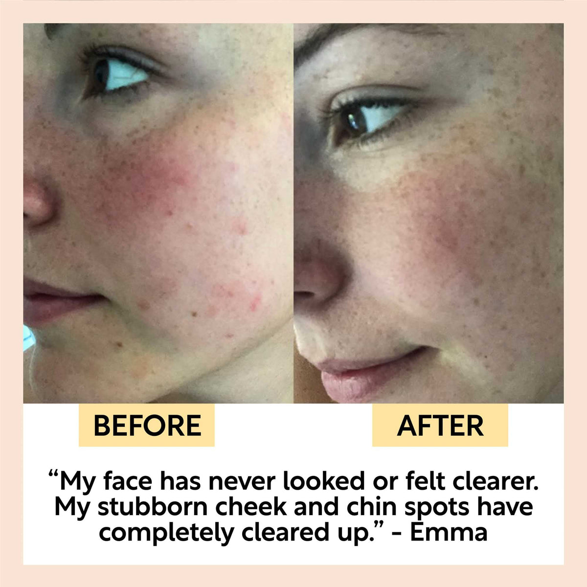 Before-and-after face photos showing skin changes after using a cleansing bar