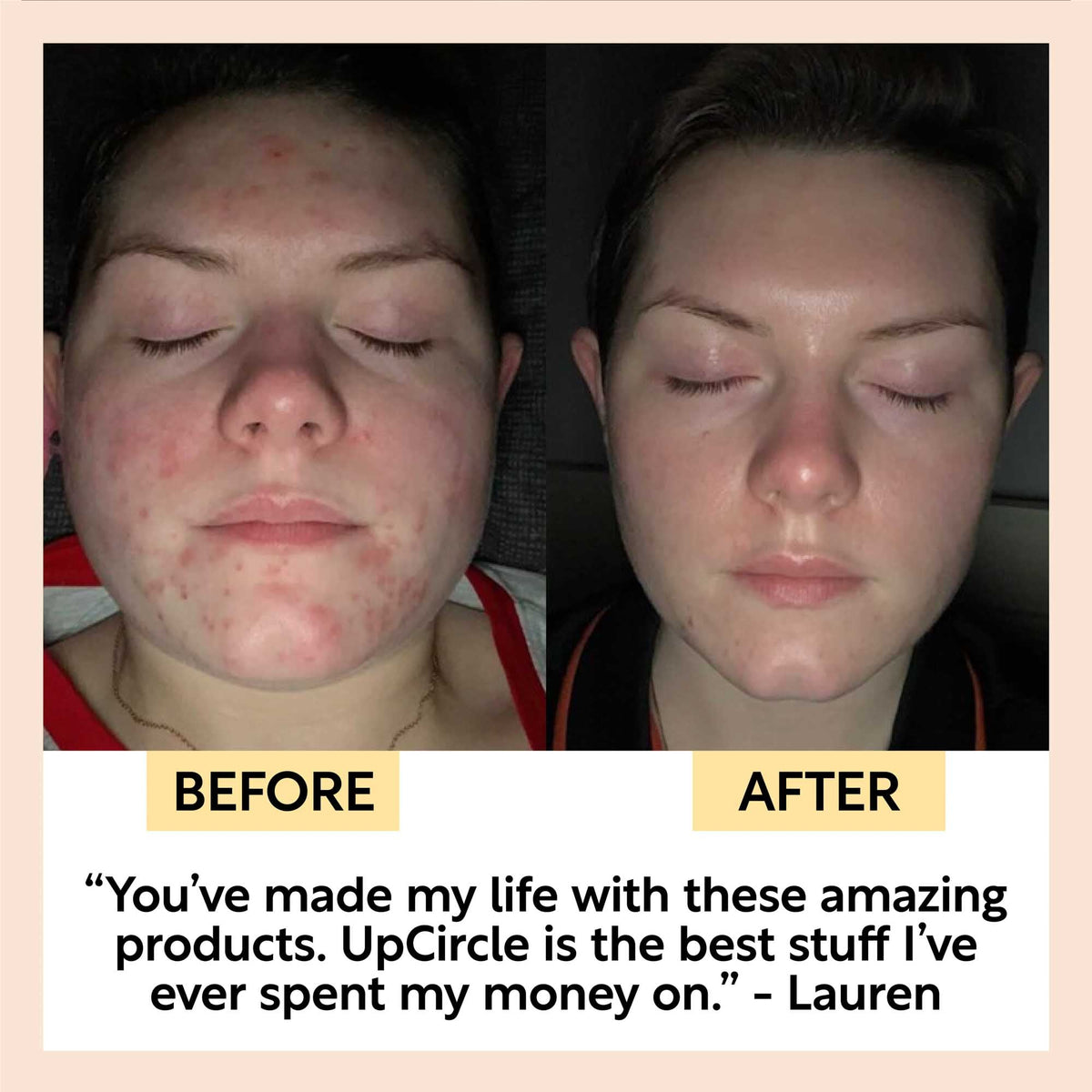 Before-and-after skin photos with face views labeled before and after