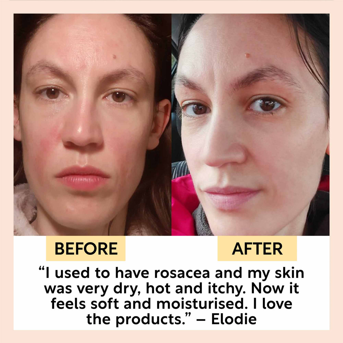 Before-and-after skin care using cleansing face milk on facial skin