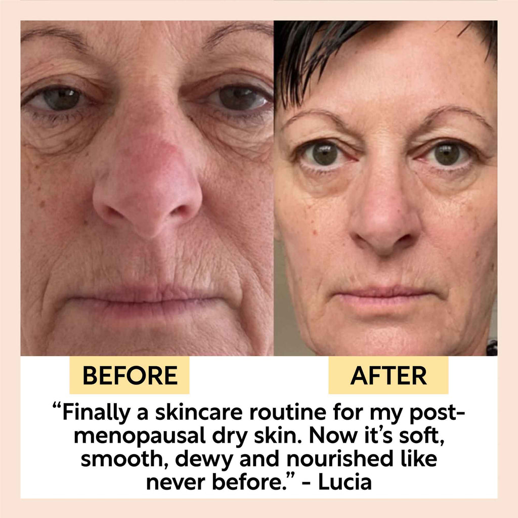 Before and after collage showing face skincare results for dry skin