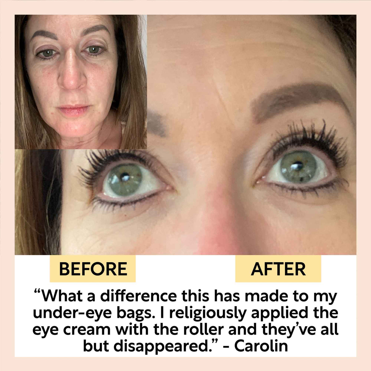 Before and after collage showing eye area skincare results