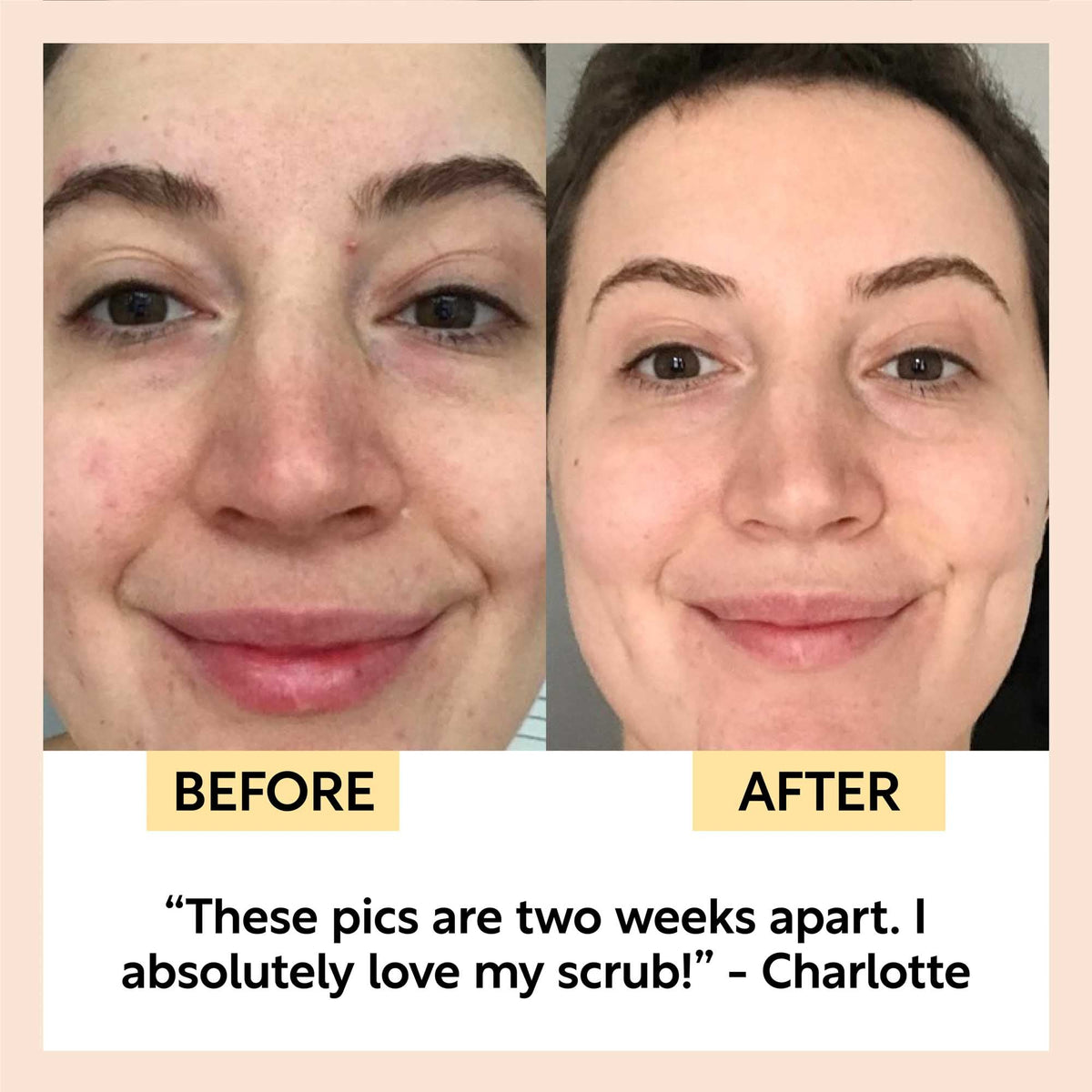 Face scrub before-and-after: two close-up faces showing skin smoothing