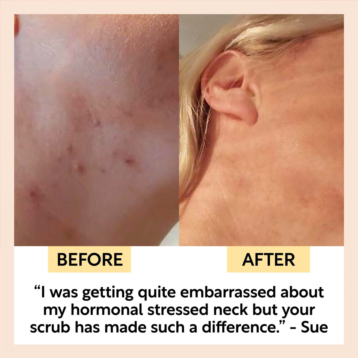 Face scrub before-and-after: visible skin with scrub residue on cheek and ear area