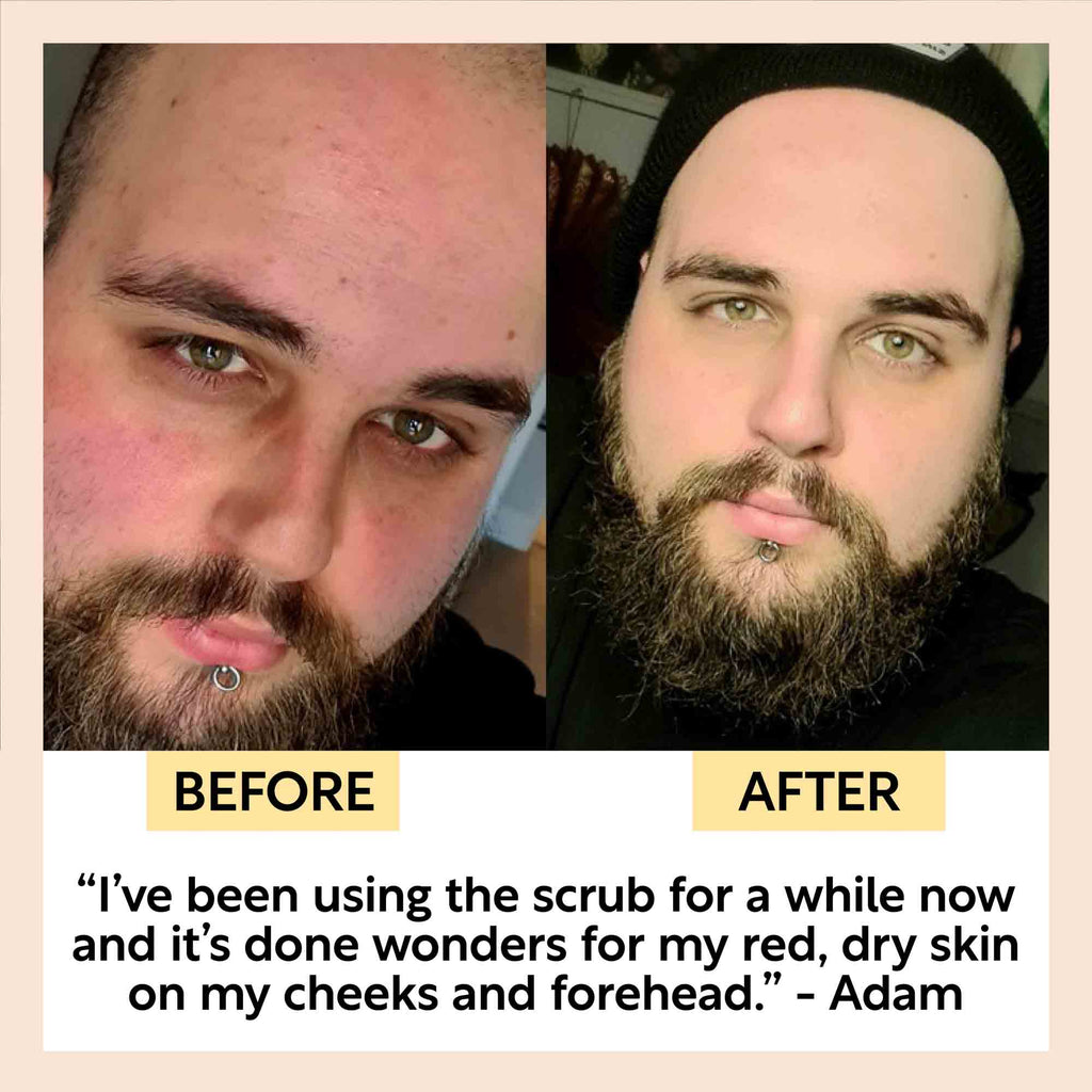 Face scrub before-and-after: two male close-ups with clearer skin on right