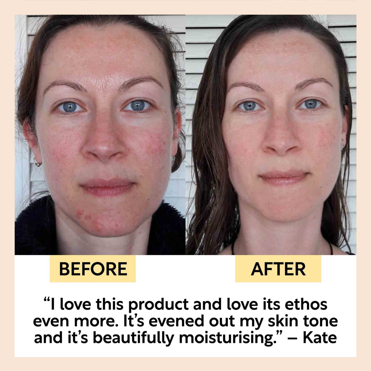 Before-and-after skincare results on two faces, showing improved complexion