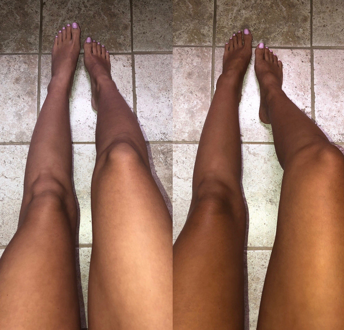 Bare feet and legs showing deep tan color on skin.