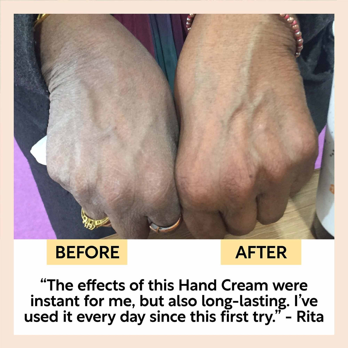 Before-and-after hands showing hand-cream results, close-up