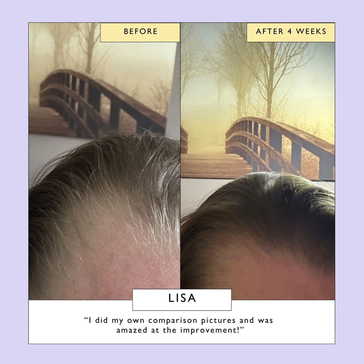 Split before-and-after hairline and scalp photo, labeled four weeks
